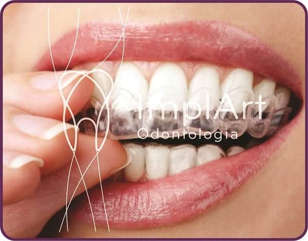 Equipamentos modernos da FaceSlim