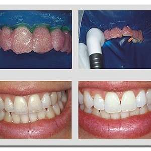 Clínica odontológica para Mesquita
